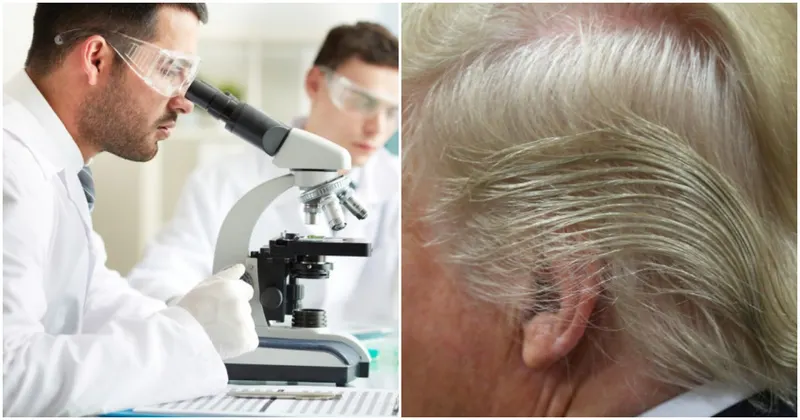 There’s A Medical Explanation For Trump’s Iconic Hairstyle